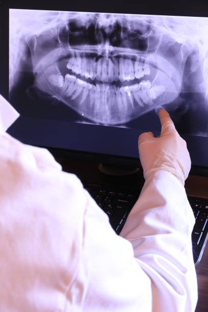 Best Emergency Root Canal Treatment in Pratt, KS